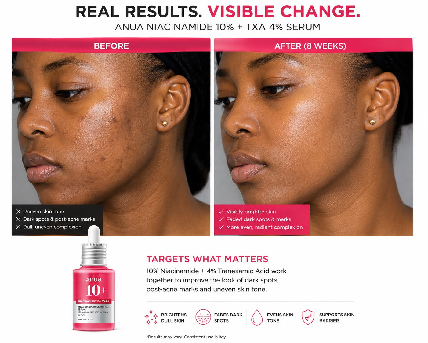 [Anua] Dark Spot Correcting Serum